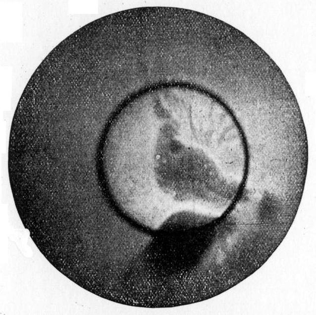 X-ray image of figures in an aluminum disc