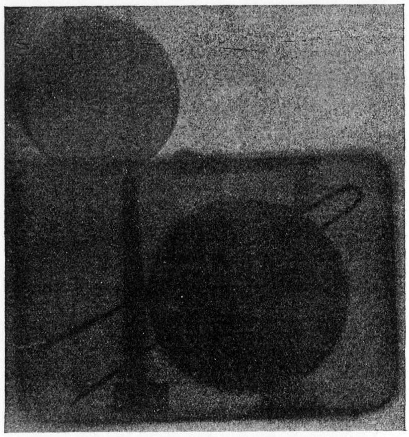 X-ray image of items in an aluminum box