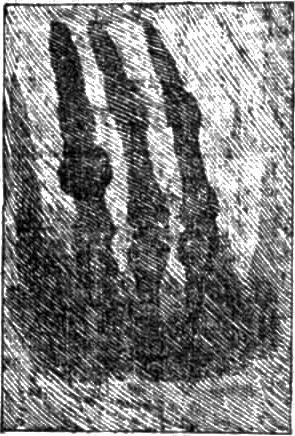 Shadowgraph - Roentgen's own negatives showing hand with ring