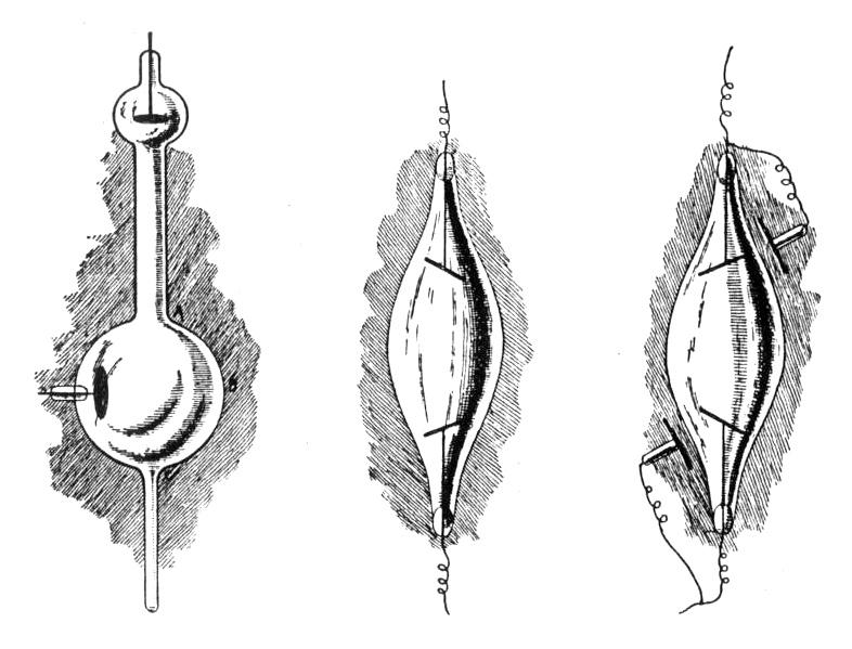 Forms of Edison's X-ray Lamps