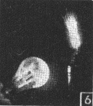 150-watt clear lamp held close to the Tesla coil.