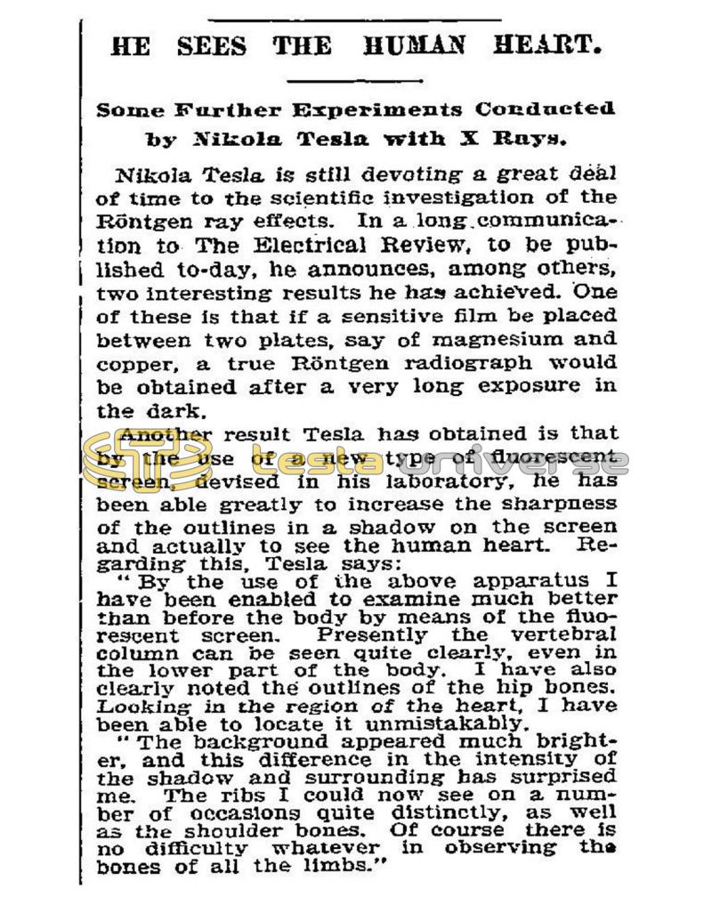 Preview of Tesla Sees the Human Heart article