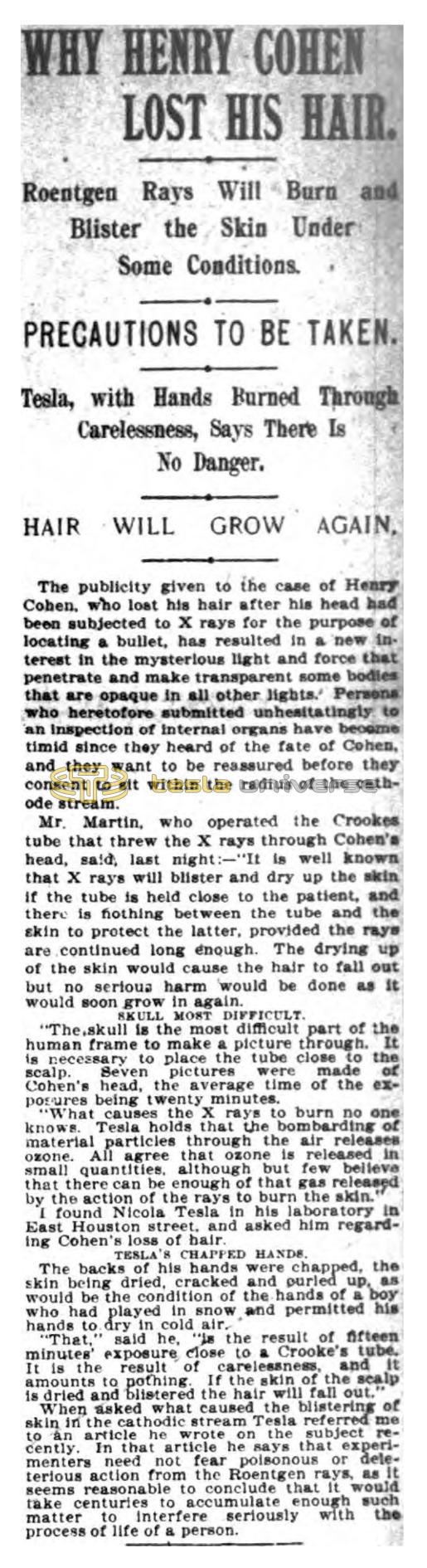 Preview of Why Henry Cohen Lost His Hair article