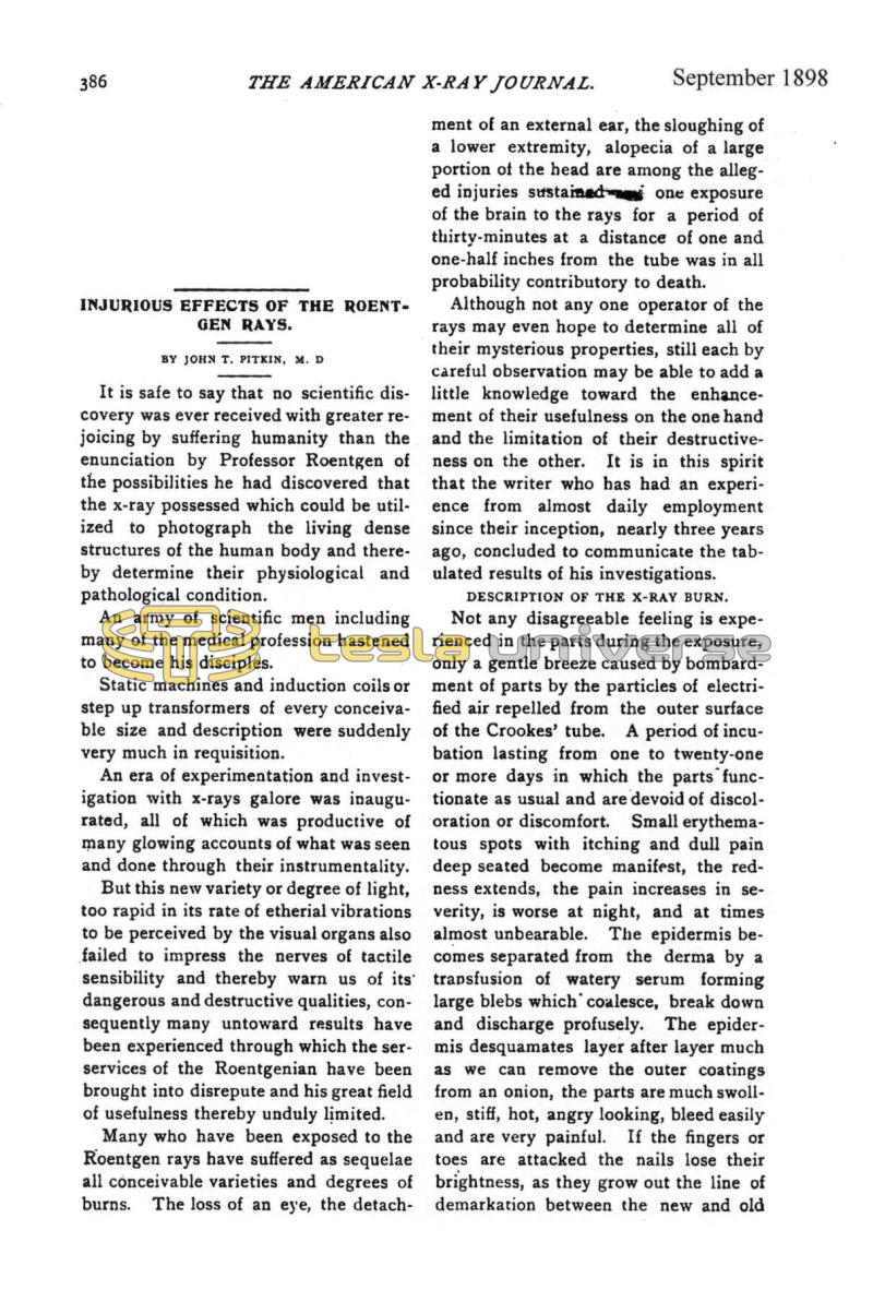 Injurious Effects of the Roentgen Rays - Page 1