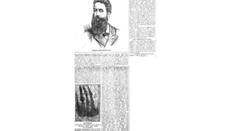 Preview of The Mystery Ray article