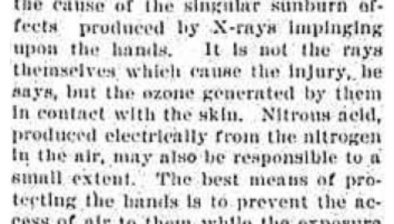 Preview of Why X-rays Burn the Skin article