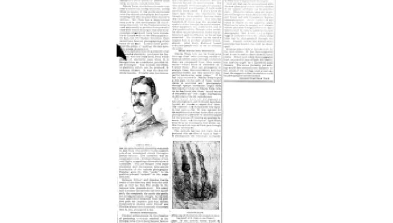 Preview of The Roentgen Ray article