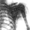 Nikola Tesla created early x-ray photo of the human body